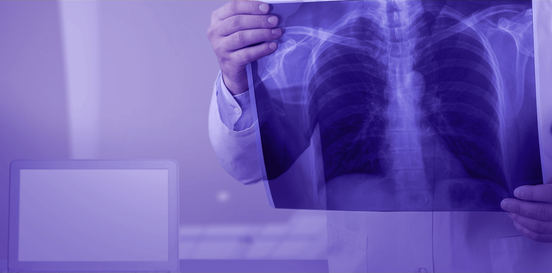 x ray (1)